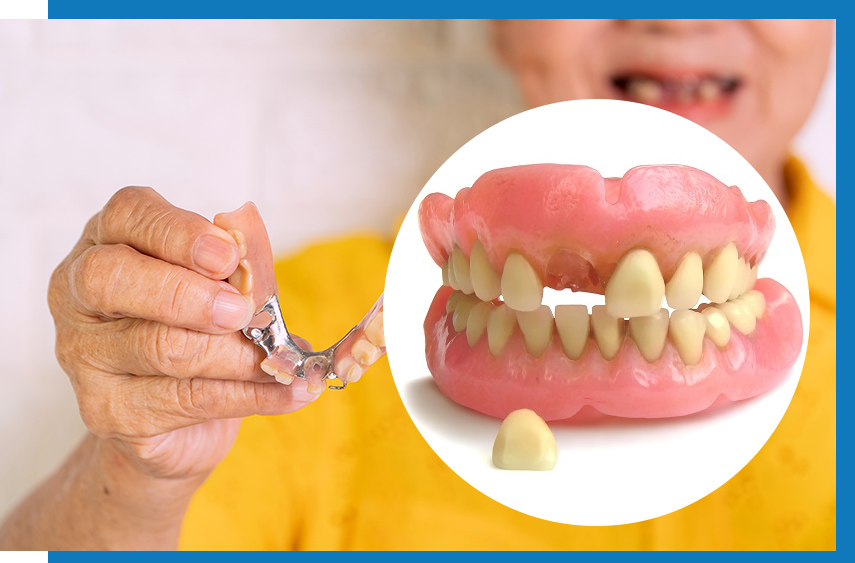 Denture Service For Missing Tooth Fix My Dentures USA